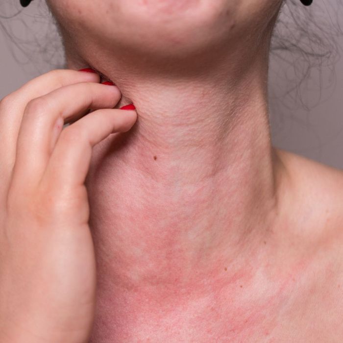 Neck Issue
