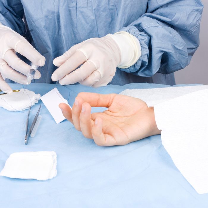 Minor Surgical Procedures